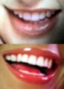 los dientes